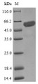 
(Tris-Glycine gel) Discontinuous SDS-PAGE (reduced) with 5% enrichment gel and 15% separation gel.