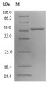 (Tris-Glycine gel) Discontinuous SDS-PAGE (reduced) with 5% enrichment gel and 15% separation gel.