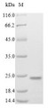 (Tris-Glycine gel) Discontinuous SDS-PAGE (reduced) with 5% enrichment gel and 15% separation gel.
