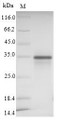 (Tris-Glycine gel) Discontinuous SDS-PAGE (reduced) with 5% enrichment gel and 15% separation gel.
