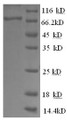 (Tris-Glycine gel) Discontinuous SDS-PAGE (reduced) with 5% enrichment gel and 15% separation gel.