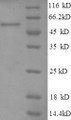 (Tris-Glycine gel) Discontinuous SDS-PAGE (reduced) with 5% enrichment gel and 15% separation gel.