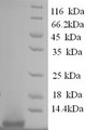 
(Tris-Glycine gel) Discontinuous SDS-PAGE (reduced) with 5% enrichment gel and 15% separation gel.
