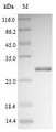 (Tris-Glycine gel) Discontinuous SDS-PAGE (reduced) with 5% enrichment gel and 15% separation gel.