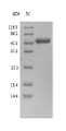 (Tris-Glycine gel) Discontinuous SDS-PAGE (reduced) with 5% enrichment gel and 15% separation gel.