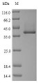 (Tris-Glycine gel) Discontinuous SDS-PAGE (reduced) with 5% enrichment gel and 15% separation gel.