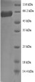 
(Tris-Glycine gel) Discontinuous SDS-PAGE (reduced) with 5% enrichment gel and 15% separation gel.