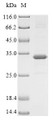 (Tris-Glycine gel) Discontinuous SDS-PAGE (reduced) with 5% enrichment gel and 15% separation gel.