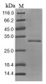 (Tris-Glycine gel) Discontinuous SDS-PAGE (reduced) with 5% enrichment gel and 15% separation gel.