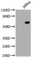 Positive WB detected in: Tag-Free SARS-CoV-2 nucleocapsid recombinant protein from Human 293 cells (HEK293) (RPC27076), SARS-CoV-2 nucleocapsid antibody at 1:1000, Secondary, Peroxidase-Affinipure Goat Anti-Human IgG, Fcγ Fragment Specific at 1/20000 dilution, Predicted band size: 45.6 kDa, Observed band size: 55 kDa