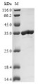 (Tris-Glycine gel) Discontinuous SDS-PAGE (reduced) with 5% enrichment gel and 15% separation gel.