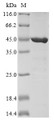 (Tris-Glycine gel) Discontinuous SDS-PAGE (reduced) with 5% enrichment gel and 15% separation gel.
