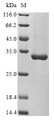 (Tris-Glycine gel) Discontinuous SDS-PAGE (reduced) with 5% enrichment gel and 15% separation gel.