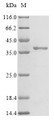 (Tris-Glycine gel) Discontinuous SDS-PAGE (reduced) with 5% enrichment gel and 15% separation gel.
