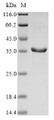 (Tris-Glycine gel) Discontinuous SDS-PAGE (reduced) with 5% enrichment gel and 15% separation gel.