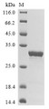 (Tris-Glycine gel) Discontinuous SDS-PAGE (reduced) with 5% enrichment gel and 15% separation gel.