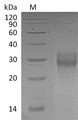 SDS-PAGE
