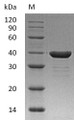 SDS-PAGE