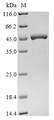 SDS-PAGE