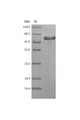 SDS-PAGE
