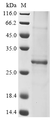 SDS-PAGE