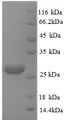 SDS-PAGE
