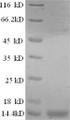 SDS-PAGE