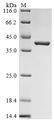 SDS-PAGE