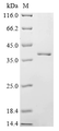 SDS-PAGE