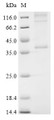 SDS-PAGE