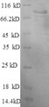 SDS-PAGE
