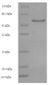 SDS-PAGE