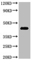 Western Blot
