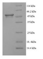 SDS-PAGE