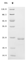 SDS-PAGE
