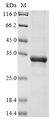 SDS-PAGE