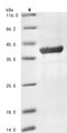 SDS-PAGE