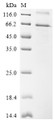 SDS-PAGE