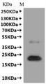 Western Blot