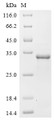 SDS-PAGE