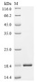 SDS-PAGE