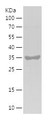 SDS-PAGE