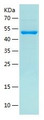 SDS-PAGE