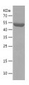 SDS-PAGE