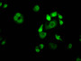Immunofluorescence staining of Hela Cells with RAC07025 at 1:50, counter-stained with DAPI. The cells were fixed in 4% formaldehyde, permeated by 0.2% TritonX-100, and blocked in 10% normal Goat Serum. The cells were then incubated with the antibody overnight at 4?. Nuclear DNA was labeled in blue with DAPI. The secondary antibody was FITC-conjugated AffiniPure Goat Anti-Rabbit IgG (H+L). Immunofluorescence staining of Hela Cells with RAC07025 at 1:50, counter-stained with DAPI. The cells were fixed in 4% formaldehyde, permeated by 0.2% TritonX-100, and blocked in 10% normal Goat Serum. The cells were then incubated with the antibody overnight at 4?. Nuclear DNA was labeled in blue with DAPI. The secondary antibody was FITC-conjugated AffiniPure Goat Anti-Rabbit IgG (H+L).