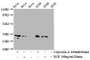 Western Blot; Positive WB detected in Hela whole cell lysate,A549 whole cell lysate(treated with Calyculin A or EGF); All lanes Phospho-CDK1/CDK2/CDK3 antibody at 0.76µg/ml; Secondary; Goat polyclonal to rabbit IgG at 1/50000 dilution; Predicted band size: 34 KDa; Observed band size: 34 KDa; Western Blot; Positive WB detected in Hela whole cell lysate,A549 whole cell lysate(treated with Calyculin A or EGF); All lanes Phospho-CDK1/CDK2/CDK3 antibody at 0.76µg/ml; Secondary; Goat polyclonal to rabbit IgG at 1/50000 dilution; Predicted band size: 34 KDa; Observed band size: 34 KDa;