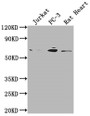 Western Blot; Positive WB detected in: Jurkat whole cell lysate, PC-3 whole cell lysate, Rat Heart tissue; All lanes: E2F1 antibody at 1:2000; Secondary; Goat polyclonal to rabbit IgG at 1/50000 dilution; Predicted band size: 47 kDa; Observed band size: 60 kDa; Western Blot; Positive WB detected in: Jurkat whole cell lysate, PC-3 whole cell lysate, Rat Heart tissue; All lanes: E2F1 antibody at 1:2000; Secondary; Goat polyclonal to rabbit IgG at 1/50000 dilution; Predicted band size: 47 kDa; Observed band size: 60 kDa;