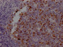 IHC image of RAC07169 diluted at 1:100 and staining in paraffin-embedded human tonsil tissue performed on a Leica BondTM system. After dewaxing and hydration, antigen retrieval was mediated by high pressure in a citrate buffer (pH 6.0). Section was blocked with 10% normal goat serum 30min at RT. Then primary antibody (1% BSA) was incubated at 4? overnight. The primary is detected by a Goat anti-rabbit IgG polymer labeled by HRP and visualized using 0.05% DAB. IHC image of RAC07169 diluted at 1:100 and staining in paraffin-embedded human tonsil tissue performed on a Leica BondTM system. After dewaxing and hydration, antigen retrieval was mediated by high pressure in a citrate buffer (pH 6.0). Section was blocked with 10% normal goat serum 30min at RT. Then primary antibody (1% BSA) was incubated at 4? overnight. The primary is detected by a Goat anti-rabbit IgG polymer labeled by HRP and visualized using 0.05% DAB.