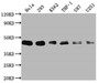 Western Blot; Positive WB detected in: Hela whole cell lysate, 293 whole cell lysate, K562 whole cell lysate, THP-1 whole cell lysate, U87 whole cell lysate, U251 whole cell lysate; All lanes: BMI1 antibody at 1:2000; Secondary; Goat polyclonal to rabbit IgG at 1/50000 dilution; Predicted band size: 37 kDa; Observed band size: 45 kDa
