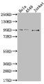 Western Blot; Positive WB detected in: Hela whole cell lysate, A549 whole cell lysate, Jurkat whole cell lysate; All lanes: CARS antibody at 1:500; Secondary; Goat polyclonal to rabbit IgG at 1/50000 dilution; Predicted band size: 86, 83, 95 kDa; Observed band size: 95 kDa Western Blot; Positive WB detected in: Hela whole cell lysate, A549 whole cell lysate, Jurkat whole cell lysate; All lanes: CARS antibody at 1:500; Secondary; Goat polyclonal to rabbit IgG at 1/50000 dilution; Predicted band size: 86, 83, 95 kDa; Observed band size: 95 kDa